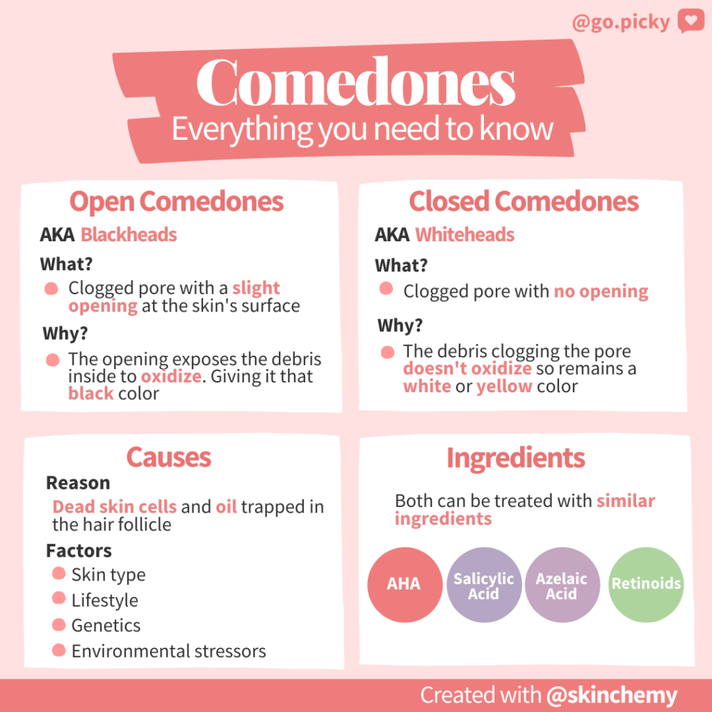 Skincare FAQ with Skinchemy Comedogenic vs. Non comedogenic